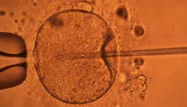 Des chercheurs repoussent la limite de la fécondation in vitro