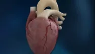 Le premier porteur d'un coeur artificiel se porte bien