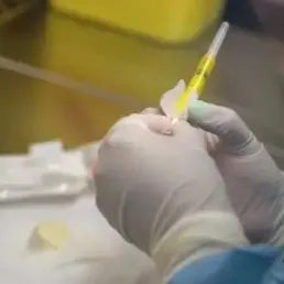 Question de santé - La kétamine pourrait soulager les patients souffrant de migraines incurables