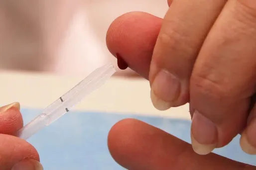 Sida/VIH : rémission d'un patient séropositif sans greffe de moelle