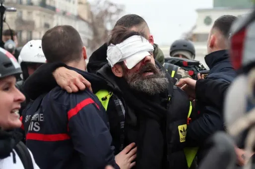 Touché à l'oeil droit lors de l'acte 11 des "gilets jaunes", Jérôme Rodrigues affirme avoir été atteint par un tir de LBD.