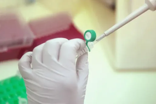 Si le nombre de découvertes de séropositivité reste stable, le dépistage est toujours trop tardif.