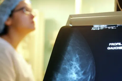 Cancer du sein : certains polluants favoriseraient les métastases