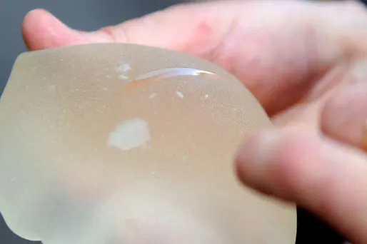 Ce processus de restitution concerne au total quelques dizaines de femmes en France.