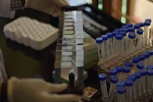 75 malades souffrant de leucémie résistante et agressive ont participé à une thérapie expérimentale. (Illustration)