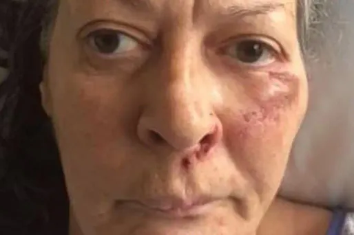 Cette femme serait âgée entre 55 et 65 ans et mesure 1m72 pour 87 kilos.