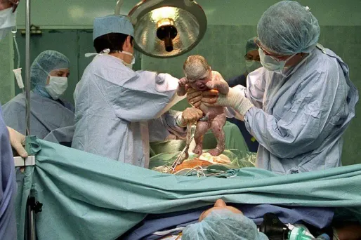 Césarienne, 1280x640