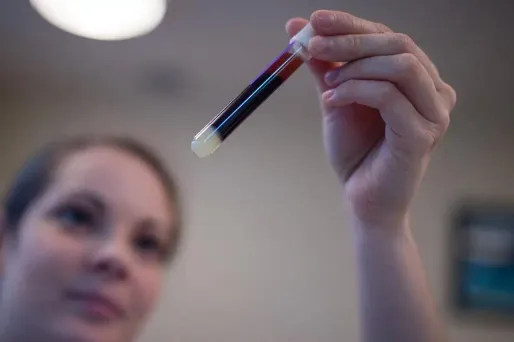 "Il n'y a pas d'urgence à agir" ce week-end, insiste le directeur de l'Association française des hémophiles. Photo d'illustration.