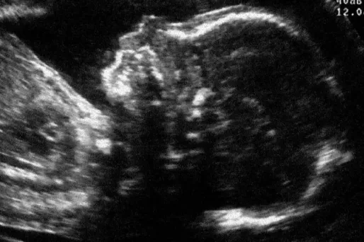 Notre latéralité se définit huit semaines avant notre naissance.