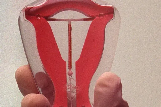 Le stérilet permettrait aux femmes d'écarter un grand nombre des risques de développer un cancer de l'utérus.