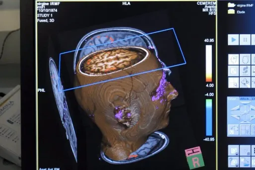 Avoir un gros cerveau ne serait pas forcément une bonne nouvelle