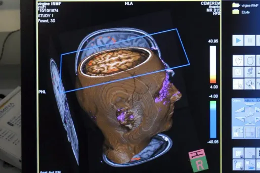 Image d'illustration.