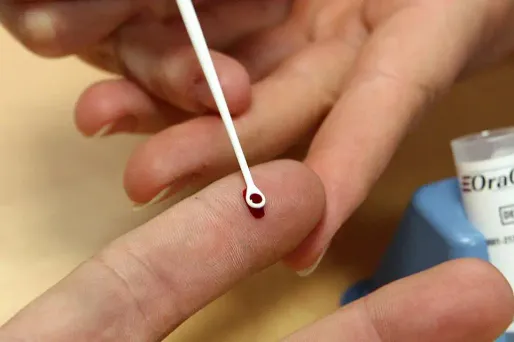 Hépatite C : les tests de dépistage rapide vont arriver d'ici la fin du mois