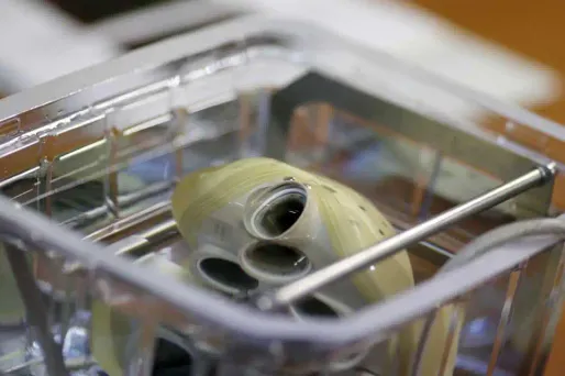 Coeur artificiel : un troisième patient greffé