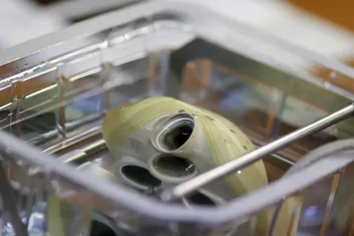 Le cœur artificiel a-t-il toujours un avenir ?