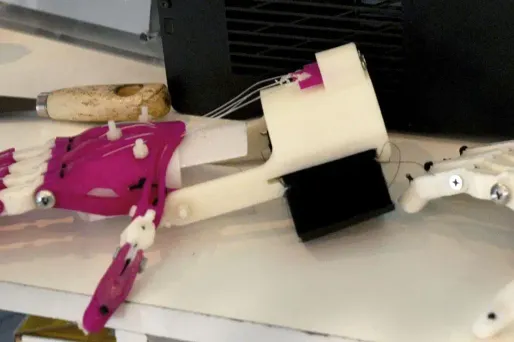 Des prothèses de main imprimées en 3D.
