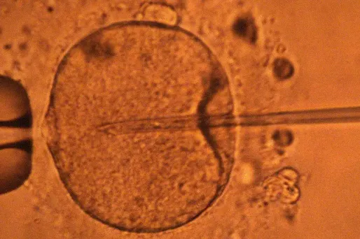 ovule fecondation 1280