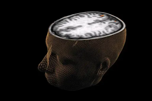 En juin 2010, Maisha Najeeb, alors âgée de 10 ans, avait été opérée à l'hôpital Great Ormond Street en raison d'un enchevêtrement de ses artères et veines risquant de provoquer une hémorragie.