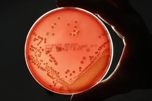 La bactérie identifiée dans les poches alimentaires du laboratoire Marette était inconnue jusque là. Photo d'illustration.