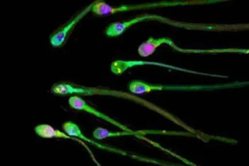 Le sperme est meilleur à Rennes qu'à Bordeaux