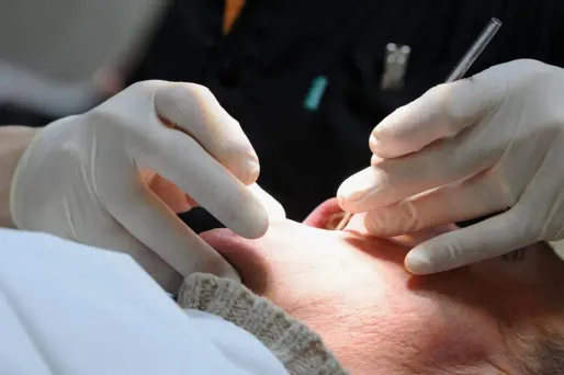 Dans la Nièvre, le "dentiste boucher" néerlandais a laissé des traces