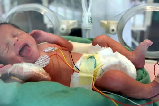 Ils demandent l'arrêt des soins pour leur bébé prématuré