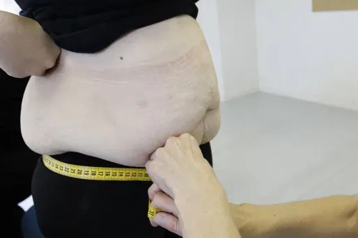 L'obésité à l'origine de près de 500.000 cancers par an