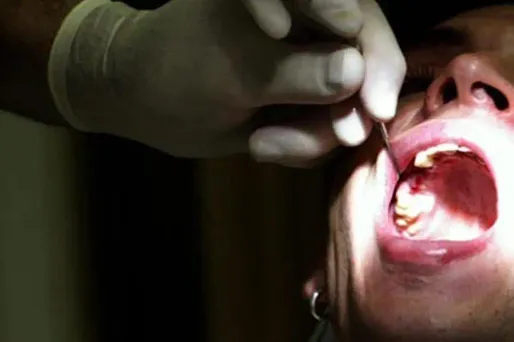 Dentistes ripoux : "c'était systématique"