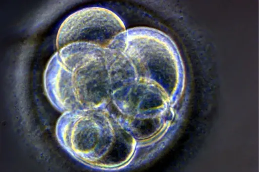 La recherche sur l'embryon à l'Assemblée