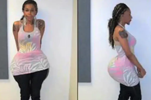 Elle injectait du ciment à ses patientes