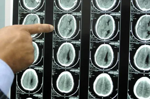 Hommes et des femmes n'ont pas le même cerveau