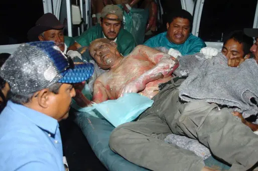 Un blessé de la prison de Comayagua au Honduras pris en charge par les secours.