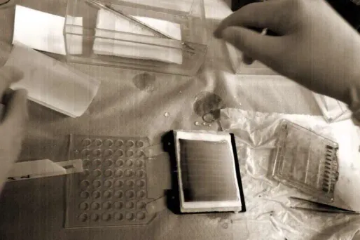 Une équipe italienne est parvenue à identifier et cloner un gène impliqué de l’anémie héréditaire.