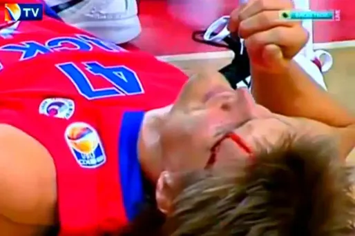 Kirilenko sérieusement blessé au visage