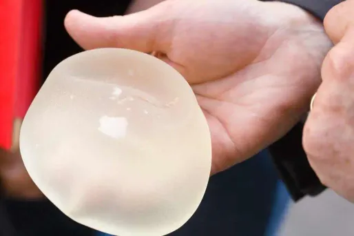 Prothèses PIP : un nouveau cas de cancer