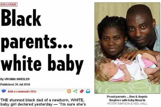 Noirs, ils mettent au monde un bébé blond