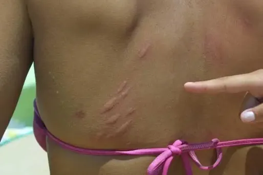 "Allô docteur, je veux des vacances zen"