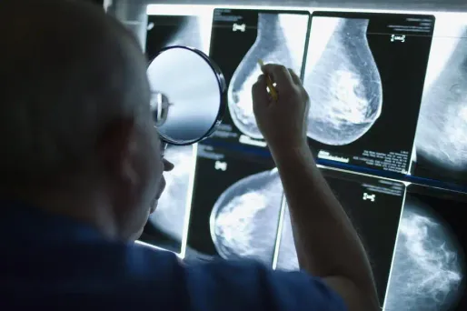 Cancer, comment éviter la rechute ?