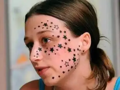 Une jeune Belge tatouée à son insu